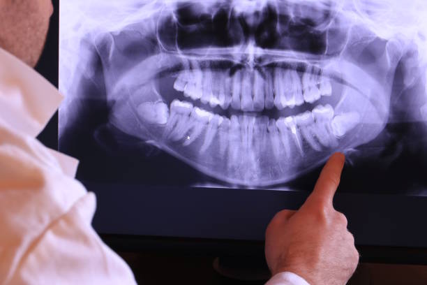 Best Emergency Root Canal Treatment in Shannon, GA